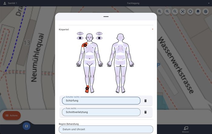 antavi 360° auf dem iPad — Patientenversorgung